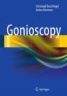 Image for Gonioscopy