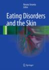 Image for Eating disorders and the skin