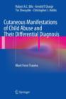 Image for Cutaneous manifestations of child abuse and their differential diagnosis  : blunt force trauma