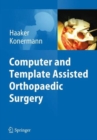 Image for Computer and Template Assisted Orthopedic Surgery