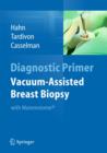 Image for Vacuum-Assisted Breast Biopsy with Mammotome(R)