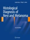 Image for Histological diagnosis of nevi and melanoma