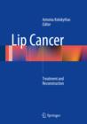 Image for Lip cancer: treatment and reconstruction
