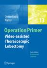 Image for Video-assisted thoracoscopic lobectomy