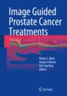 Image for Image Guided Prostate Cancer Treatments