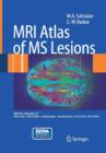 Image for MRI Atlas of MS Lesions