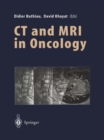 Image for CT and MRI in Oncology