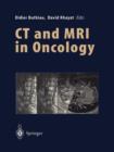 Image for CT and MRI in Oncology