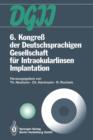 Image for 6. Kongress der Deutschsprachigen Gesellschaft fur Intraokularlinsen Implantation