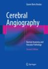 Image for Cerebral Angiography