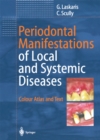 Image for Periodontal Manifestations of Local and Systemic Diseases: Colour Atlas and Text