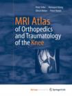 Image for MRI Atlas of Orthopedics and Traumatology of the Knee