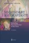 Image for Secondary Rhinoplasty: Including Reconstruction of the Nose