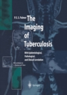 Image for Imaging of Tuberculosis: With Epidemiological, Pathological, and Clinical Correlation