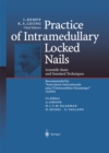 Image for Practice of Intramedullary Locked Nails: Scientific Basis and Standard Techniques Recommended &amp;quot;Association Internationale pour I&#39;Osteosynthese Dynamique&amp;quot; (AIOD)