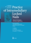 Image for Practice of Intramedullary Locked Nails: Advanced Techniques and Special Applications Recommended by &amp;quot;Association Internationale pour l&#39;Osteosynthese Dynamique&amp;quot; (AIOD)