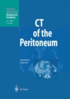 Image for CT of the Peritoneum