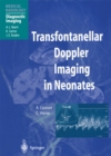 Image for Transfontanellar Doppler imaging in neonates