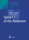 Image for Spiral CT of the Abdomen