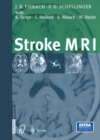 Image for Stroke MRI