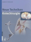 Image for Neue Techniken Kniechirurgie