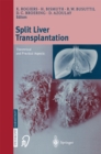 Image for Split liver transplantation: Theoretical and practical aspects