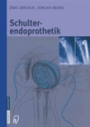 Image for Schulterendoprothetik: Indikation, Implantate, OP-Technik, Nachbehandlung, Begutachtung