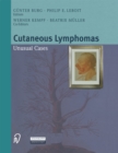 Image for Cutaneous Lymphomas: Unusual Cases