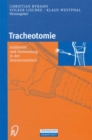 Image for Tracheotomie: Indikation und Anwendung in der intensivmedizin