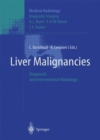 Image for Liver Malignancies: Diagnostic and Interventional Radiology