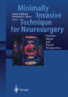 Image for Minimally Invasive Techniques for Neurosurgery: Current Status and Future Perspectives