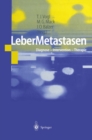 Image for Lebermetastasen: Diagnose - Intervention - Therapie