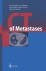 Image for CT of Metastases