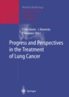 Image for Progress and Perspective in the Treatment of Lung Cancer