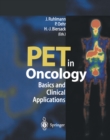 Image for PET in Oncology: Basics and Clinical Application