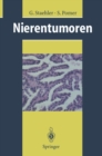 Image for Nierentumoren: Grundlagen, Diagnostik, Therapie