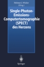 Image for Single-Photon-Emissions-Computertomographie (SPECT) des Herzens