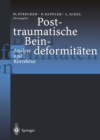 Image for Posttraumatische Beindeformitaten: Analyse und Korrektur