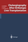 Image for Cholangiography After Orthotopic Liver Transplantation