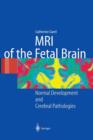 Image for MRI of the Fetal Brain : Normal Development and Cerebral Pathologies