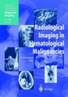 Image for Radiological Imaging in Hematological Malignancies