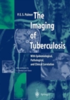 Image for The Imaging of Tuberculosis : With Epidemiological, Pathological, and Clinical Correlation