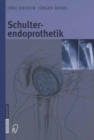 Image for Schulterendoprothetik