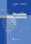 Image for Shoulder Arthroplasty