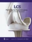Image for LCS® Mobile Bearing Knee Arthroplasty