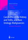 Image for Carcinoma of the Kidney and Testis, and Rare Urologic Malignancies