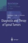 Image for Diagnosis and Therapy of Spinal Tumors