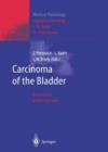 Image for Carcinoma of the Bladder : Innovations in Management