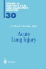 Image for Acute Lung Injury