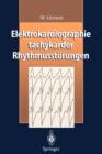 Image for Elektrokardiographie tachykarder Rhythmusstoerungen